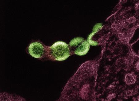 An Isolated Viral Load Test May Generate False Positive Results for People Using Long-Acting PrEP